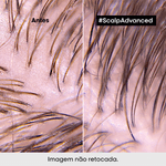 Mascara-L-Oreal-Professionnel-Serie-Expert-Scalp-Advanced-500ml-03