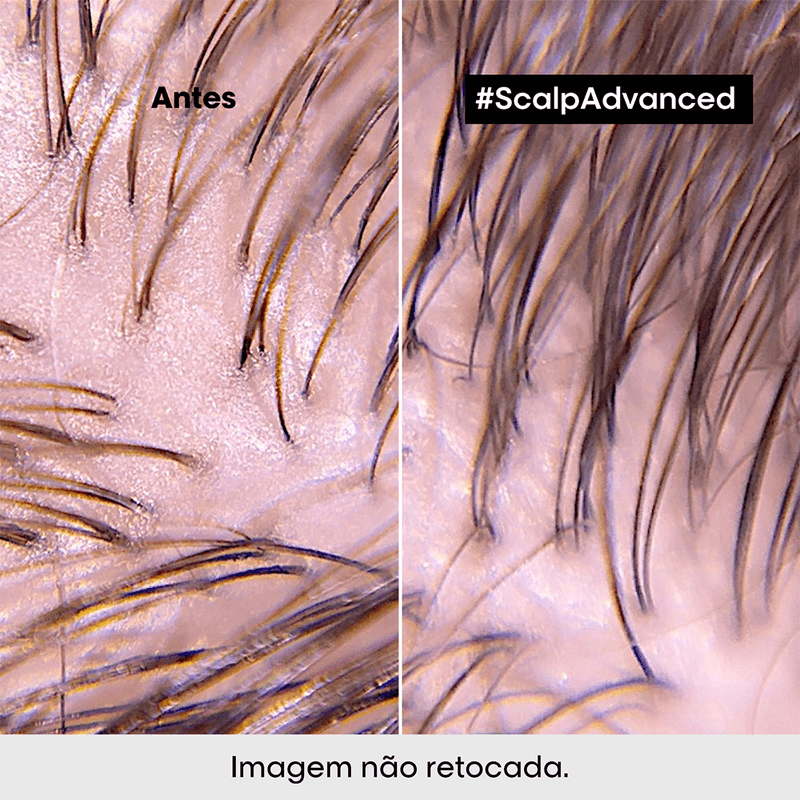 Mascara-L-Oreal-Professionnel-Serie-Expert-Scalp-Advanced-500ml-03