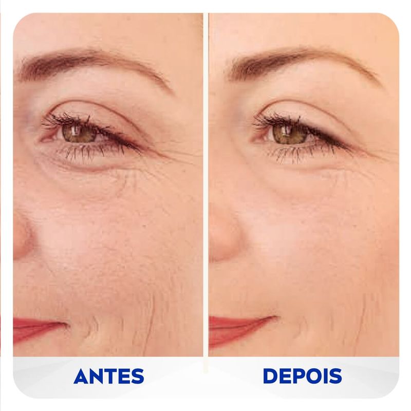 4005900992840_2NIVEA-Preenchedor-Q10-Expert-Antissinais-15ml--1-